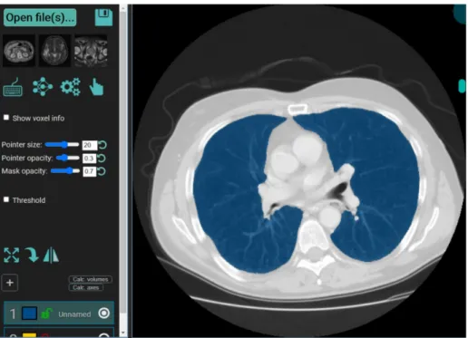 Figure 8. Segmentation of the lung in CT slice using the MedSeg tool.