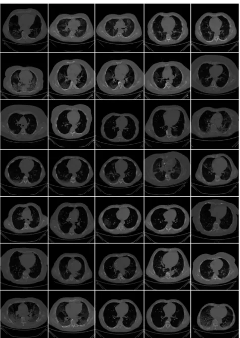 Figure 2. Raw CT images from NOVARA, ITALIAN dataset [3].