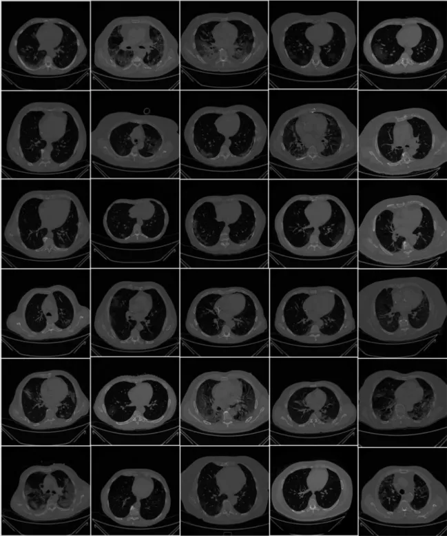 Figure 2. Raw lung COVID-19 CT images were taken from different patients in the database.