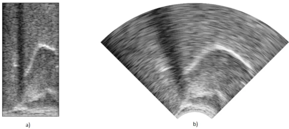 2. ábra: Az ultrahang-felvételek megjelenítése a) a nyers adattömbnek megfele- megfele-lő négyzetes elrendezésben b) interpolációval emegfele-lőállítható, anatómiailiag korrekt elrendezésben.