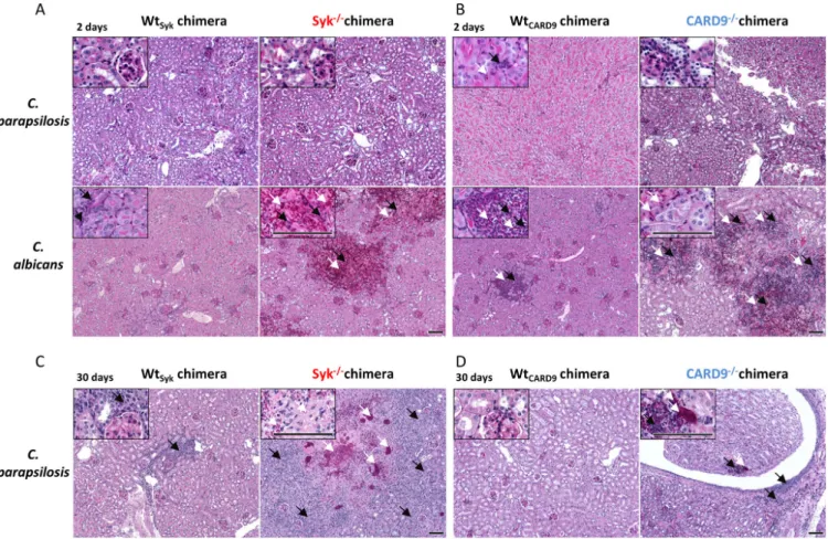 FIG 6 Histopathology of kidneys during C. parapsilosis and C. albicans infection. Wt Syk , Syk 2/2 (A and C) Wt CARD9 , and CARD9 2/2 (B and D) bone marrow chimeric mice were infected i.v