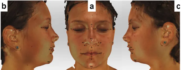 Figure 2. Landmarks used in our study located on the 3D-facial images. (a) Frontal view (b) and (c) lateral views.