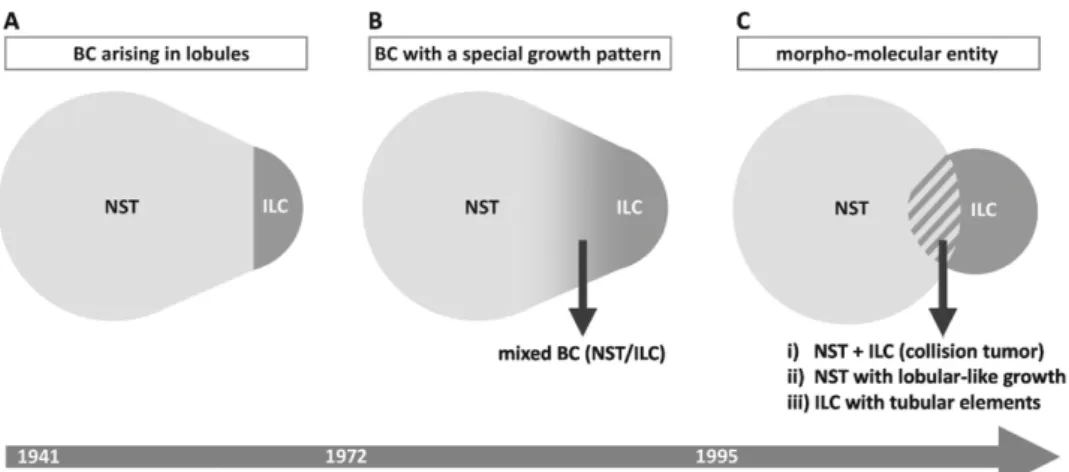 Figure 1. Different concepts of ILC as a special tumor entity and their implications. This is a Venn diagram-like schematic  presentation of the relation between BC of NST and ILC, according to different concepts