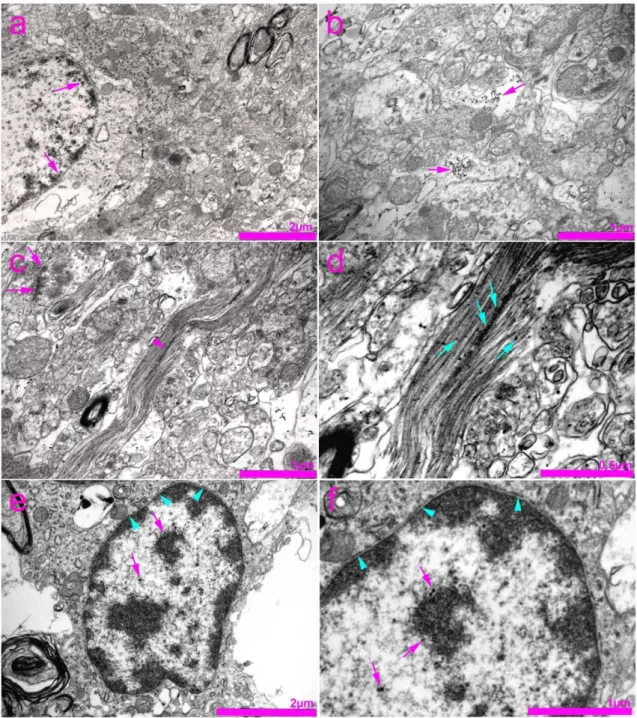 Figure 5. Transmission electron microscopy (TEM) photomicrographs of the rat spinal cord showing immunogold staining  for connexin 37 (Cx37)