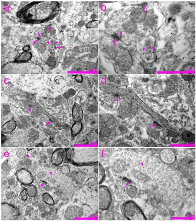 Figure 8. Transmission electron microscopy (TEM) photomicrographs of the rat spinal cord showing immunogold staining  for connexin 40 (Cx40)