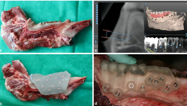 Fig. 1. Preparations for the apicoectomies. (a) a porcine mandible with teeth; (b) impression taking in an individualized tray with gutta-percha markers; (c) digital planning; (d) the 3D- printed, tooth-supported surgical guide on the porcine mandible.