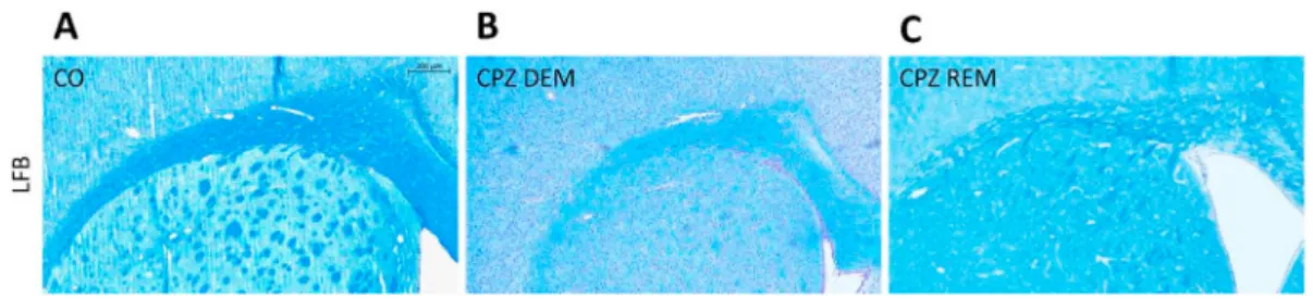 Figure 5. Myelin content determination of the corpus callosum with MBP staining in the CO (A), DEM (B) and REM (C) group, where the CPZ demyelination group (B) showed less myelin content, which increased in the remyelination phase (C)