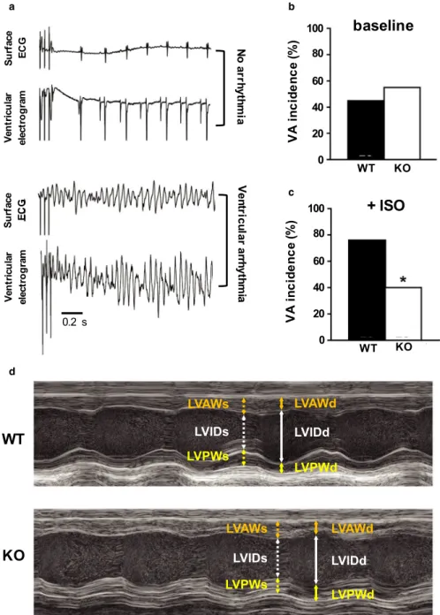 FIGURE 1  Alterations of ventricular electrophysiology and function in Kcna1 ⎯/⎯  mice