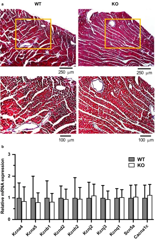 FIGURE 3  Absence of obvious structural and expression remodeling in Kcna1 ⎯/⎯  mice. (A) Representative images of ventricular sections from  WT (n = 5) and KO (n = 5) animals stained with Masson's trichrome to visualize fibrosis