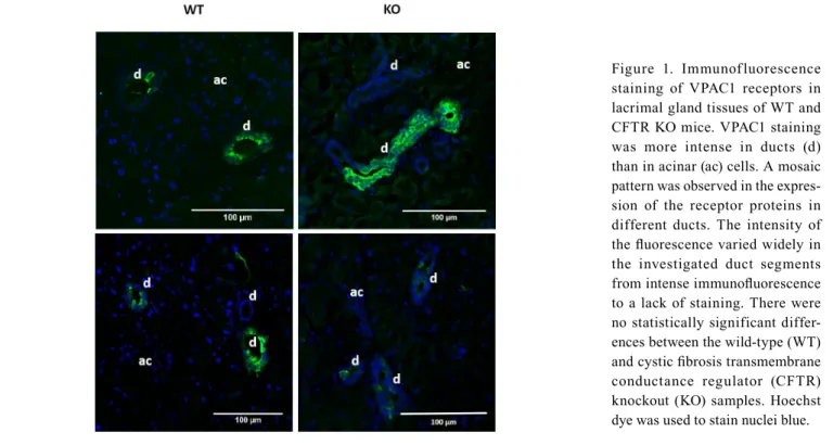 Figure 2. Immunofluorescence  staining of VPAC2 receptors in  lacrimal gland tissues of WT and  CFTR mice