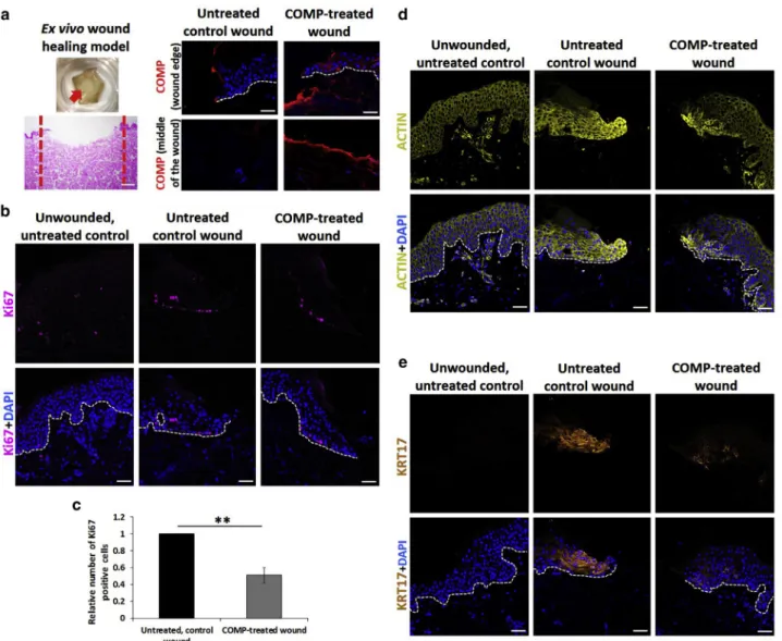 Figure 5. COMP has a negative effect on keratinocyte proliferation and is involved in keratinocyte migration and activation in ex vivo wound models.