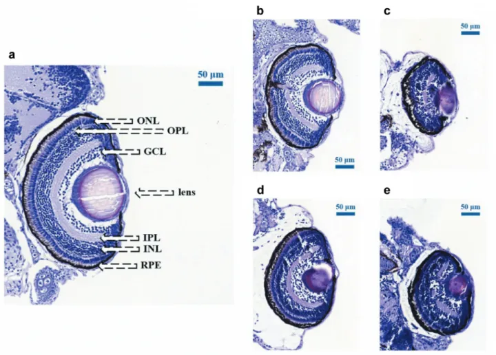 Figure 4. Dose-dependent changes in the eye size after photon and proton irradiation. Hematoxylin and eosin stained coronal retinal sections of untreated zebrafish embryos (a) after treatment with (b) 10 Gy, (c) 15 Gy of 6 MV photons and with (d) 10 Gy, (e