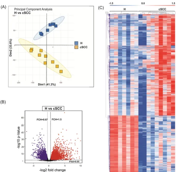 Figure 1.  Analysis of the protein-coding transcriptome in cSCC. (A) Principal component analysis of samples  obtained frmo healthy skin samples (H; blue) and cSCC (cSCC; yellow) based on RNA-seq data