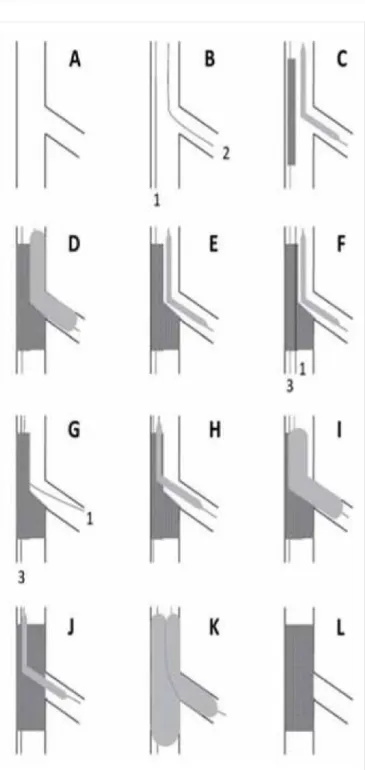 7. ÁBRA.  Highway-technika (HW) alkalmazásának illusztráci­