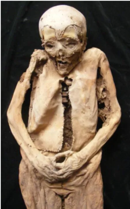 1. ábra: Swartz Mária Terézia mumifikálódott teste a boncolás nyomával (fotó: Szikossy Ildikó)