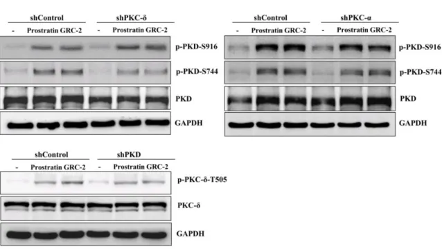 Figure 4. Knockdown of PKC-δ/PKD attenuates the cytotoxicity of prostratin and GRC-2 in A549 cells