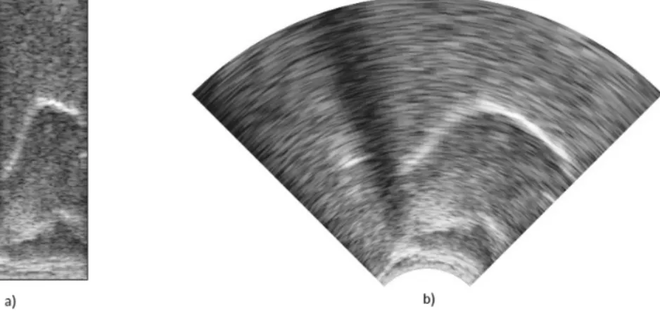 Fig. 2. Example of displaying the ultrasound recordings as a) a rectangular image of raw data samples b) an anatomically correct image, obtained by interpolation.