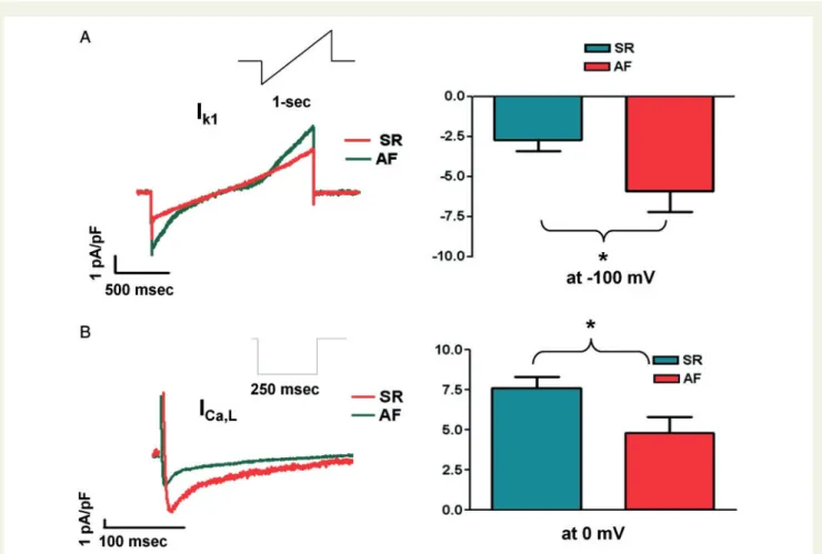 Figure 5 Ionic current changes in AF. Representative recordings and mean ± SEM current densities from LA cardiomyocytes of patients in SR and AF