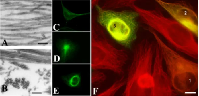 Figure 1. Tubulin Polymerization Promoting Protein (TPPP/p25)-derived ultrastructural organization  of microtubules