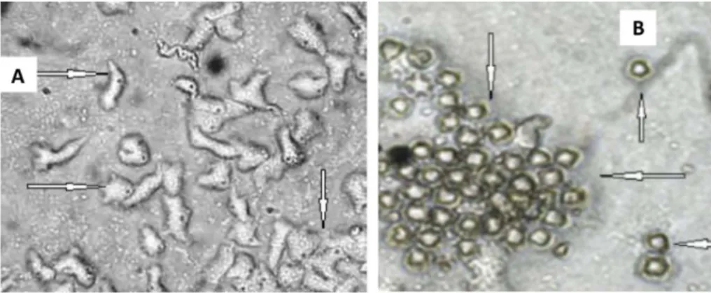 Figure 1. Photomicrograph of Acanthamoeba trophozoites (A) and cysts (B) with 400 × magni ﬁ cation