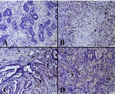 Fig. 3. IGF-II expression in the tumours. (A) Slight expression (arrow) in a mammary adenoma; (B) Moderate expression (arrows) in a benign mixed tumour; (C) Marked expression (arrows) in a mammary adenocarcinoma; (D) Increased expression (arrows) in a mali