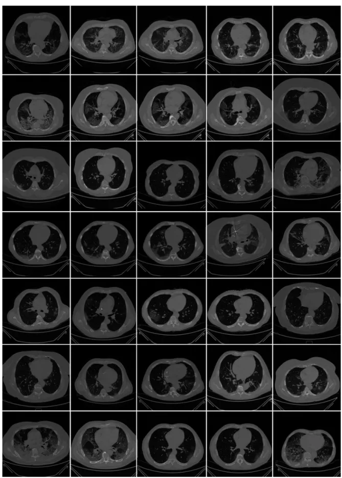 Figure 2. Raw lung COVID-19 CT scans taken from different patients in the database. 