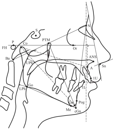 Figure 1 Reference cephalometric landmarks and lines used in this study.