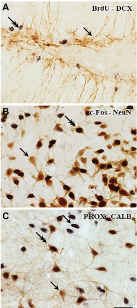 Figure 1. Double immunohistochemical staining for light  microscopy. Nuclear antigens were stained with primary  anti-bodies against BrdU, Prox-1, and c-Fos, which were revealed  with DAB-Ni