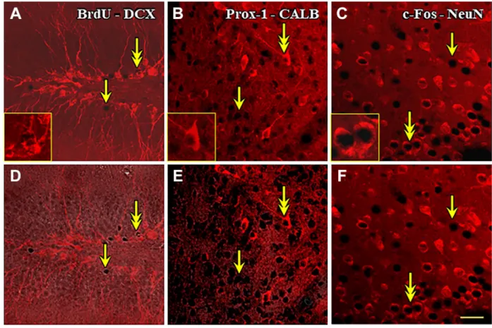 Figure 2.  Double immunohistochemical staining for combined bright-field/fluorescence microscopy