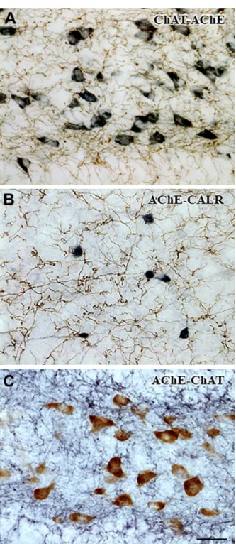 Figure 3. Double labeling with AChE enzyme histochemistry  and immunohistochemistry for neuronal markers