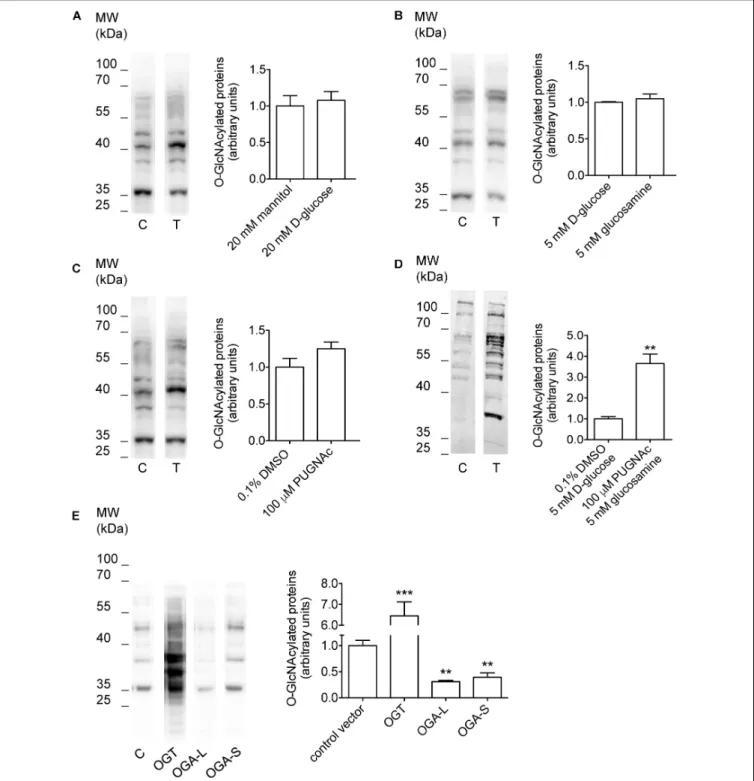 FIGURE 1 | Manipulation of O-GlcNAcylation levels of cellular proteins. HEK 293 Phoenix cells were incubated for 1 h in complete medium with (A) 20 mM mannitol (control) or D -glucose, (B) 5 mM D -glucose (control) or glucosamine, (C) 0.1% DMSO (control) o