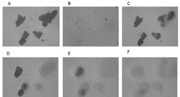 Figure 2. HSM micrographs for ABZ at different temperatures: (A)—ABZ at 25 °C; (B)—