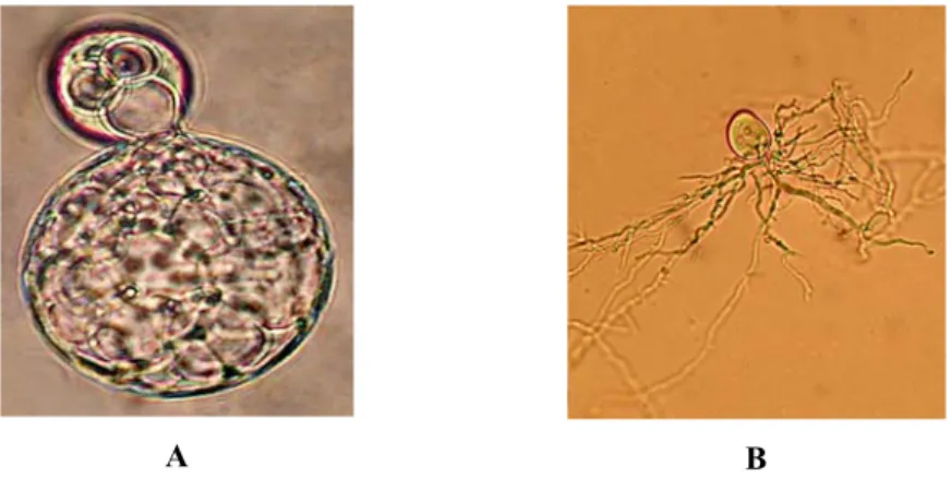Şekil 1. Küresel rizoide sahip olan Caecomyces sp. GMLF12 (A) ve filamentli rizoide 