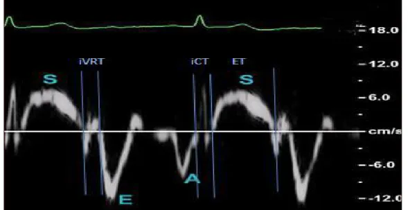Şekil 8. Doku Doppler ekokardiyografi yöntemiyle sistolik, diyastolik dalgaların ve  zamanların gösterilmesi 