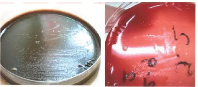 Şekil 4: Helicobacter agar ve Kanlı agarda Hp kolonileri (146) 