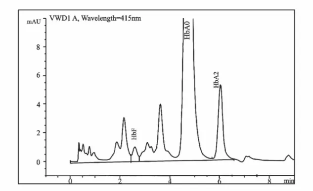 Şekil 3.1 Hemoglobin elektroforezi    3.4.2 β-Globin Geni Mutasyon Analizi