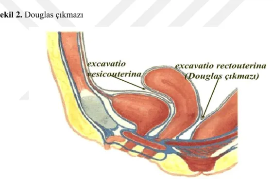 Şekil 2. Douglas çıkmazı 