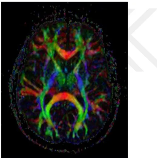 Şekil 11: Beynin aksiyel renkle kodlanmış difüzyon tensor harita görüntüsü (82). 