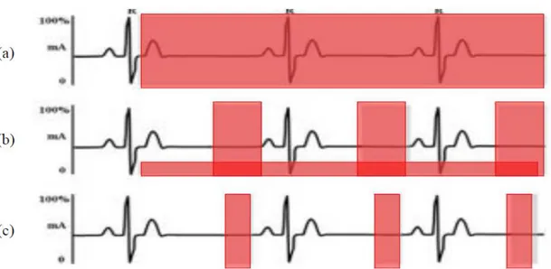 Şekil 15:  a)  Retrospektif  EKG  pencerelemede  tüm  kalp  döngüsü  boyunca radyasyon    expojuru  vardır