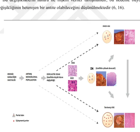 Şekil 4: Hepatokarsinogenez 