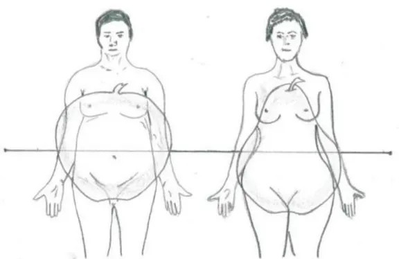 Şekil 2.3.  Obezite Tipleri (22, 23) 