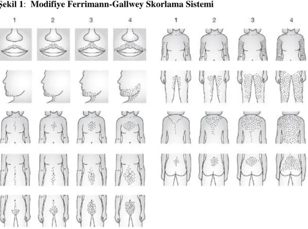 Şekil 1:  Modifiye Ferrimann-Gallwey Skorlama Sistemi 