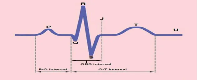 Şekil 3: Normal EKG  2.4. QT İntervali 