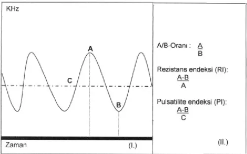 Şekil 3. A: Zirve sistolik akım hızı (PSV), B: Diastol sonu hız (EDV), C: Ortalama hız (Mean Velocity) 