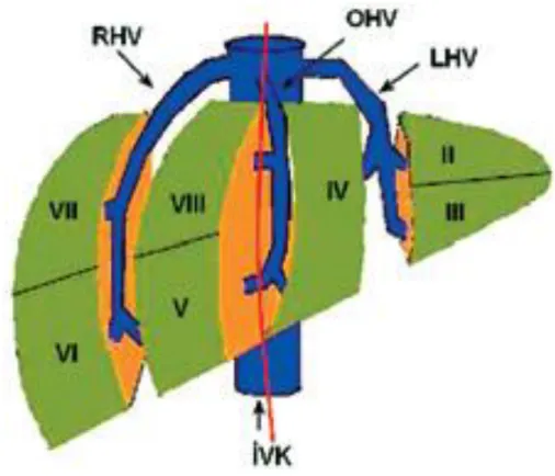 Şekil  1.  Sağ  anterolateral  oblik  bakışta  karaciğer  segmental  anatomisi  ve  venöz  drenajı  Kısaltmalar; RHV:Sağ hepatik ven, OHV: Orta hepatik ven LHV: Sol hepatik ven İVK: İnferior  vena kava (11)