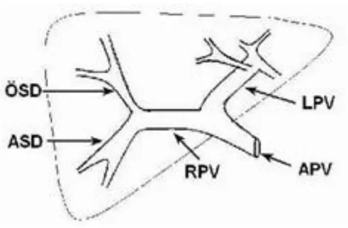 Şekil 2. Normal portal ven anatomisi Kısaltmalar; APV: Ana portal ven RPV: Sağ portal ven  LPV: Sol portal ven   ÖSD:Ön sektörial dal ASD: Anterior sektörial dal (11) 