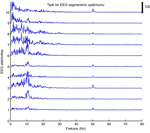 ġekil 6: Tipik bir EEG segmentinin spektrumu 