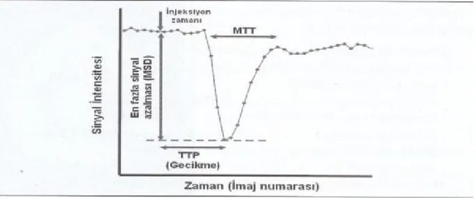 Şekil 2. Perfüzyon MRG tekniği sinyal-zaman intensitesi grafiği 