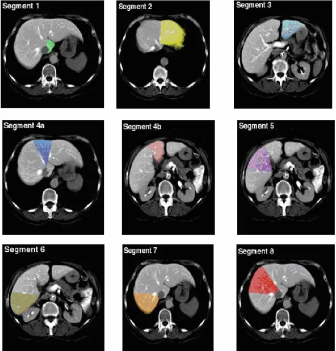 Şekil 2. Bistmuth sistemine göre karaciğerin segmental anatomisi (10). 