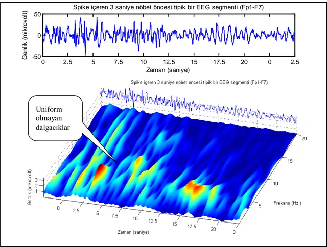 Şekil  4. Epileptik  bir  EEG işaretinde nöbetten  3  saniye  önce  zaman-frekans  karakteristiğinde nasıl  bir  değişme olduğu gösterilmiştir